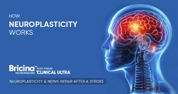 Rebuild Nerve Pathways. Restore Movement. Neuroplasticity That Changes Recovery.